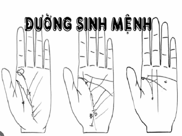 Đường sinh đạo (Đường sinh mệnh) 